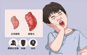 图片加载失败