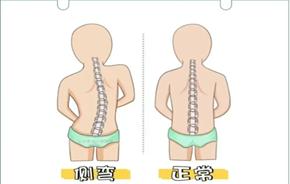图片加载失败